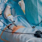 Artikel kali ini membahas tentang beberapa teknologi bedah terbaik di banyak sektor kesehatan modern yang dikutip dari beberapa sumber.