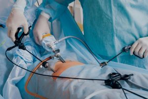 Artikel kali ini membahas tentang beberapa teknologi bedah terbaik di banyak sektor kesehatan modern yang dikutip dari beberapa sumber.